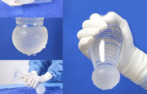 Phễu không chạm trong nâng ngực