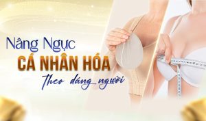 Nâng ngực cá nhân hóa theo dáng người