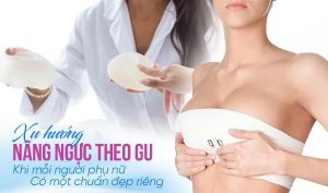 Xu hướng nâng ngực theo gu