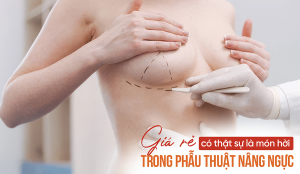 Giá rẻ có thật sự là món hời trong phẫu thuật nâng ngực