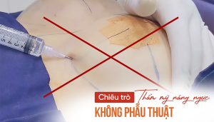 Chiêu trò thẩm mỹ không phẫu thuật