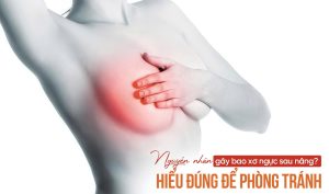 Bao xơ ngực sau nâng