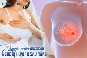 Dấu hiệu âm thầm của hoại tử sau nâng ngực