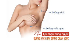 Nên nâng ngực đường nách hay đường chân ngực?
