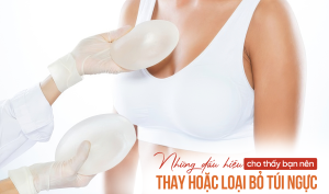 Những dấu hiệu cho thấy bạn nên thay hoặc loại bỏ túi ngực