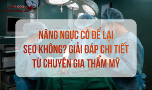 nâng ngực